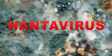 Hantavirus
